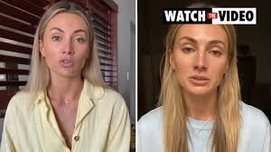 Model's warning after freckle turned out to be skin cancer