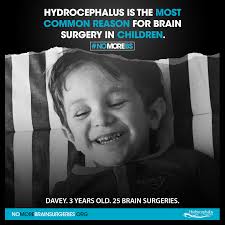 Hydrocephalus Association
