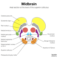 The most lateral nuclei in the brainstem are somatic sensory and special somatic sensory nuclei. Midbrain Radiology Reference Article Radiopaedia Org