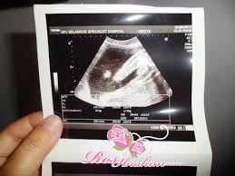 Gambar Scan Bayi Dalam Kandungan Ultrasound Baby 6 Bulan Scan Jantina Bayi Koleksi Resepi Face Mask Kain Cotton Tips Keibubapaan