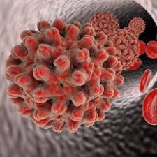 It is a type of viral hepatitis. Hepatitis B Hbv Medlineplus