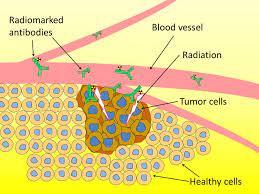Dandelion root may kill 98% of cancer cells within 48hr, the april 25 post reads. Astatine An Ally Against Cancer Cnrs News