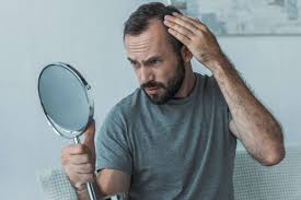 Experiencing extra hair loss can be stressful, but it may only be a temporary issue as your body recovers and adjusts after your hysterectomy. Hair Loss Therapy With Platelet Rich Plasma Prp Alternity Healthcare