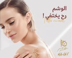 أفضل التقنيات لازالة التاتو الدائم و المؤقت✨ للحجز و الاستفسار : 032013002 