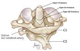 All of the other joints in the vertebrae are gliding joints. Biomechanics Of The Craniovertebral Junction Intechopen