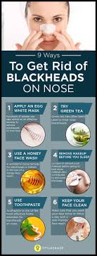 How To Remove Blackheads On Nose At Home Fast Get Rid Of Blackheads Blackheads On Nose Remove Blackheads From Nose