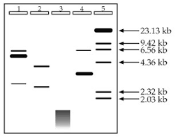 gel electrophoresis assignment 1