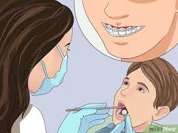 With braces and bands, it's easier for food to get stuck in the metal; How To Get Your Braces Off Faster 14 Steps With Pictures