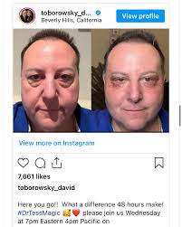 Dr. Tess Mauricio, MD FAAD