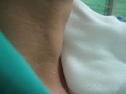 9,795 likes · 114 talking about this. Ung ThÆ° Tuyáº¿n Giap Cach Phat Hiá»‡n Va Ä'iá»u Trá»‹ Khoahoc Tv
