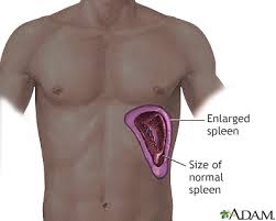 FloridaHealthFinder | Enlarged spleen | Health Encyclopedia |  FloridaHealthFinder
