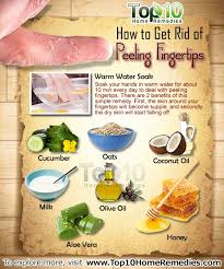 My hands peel whenever i use bleach. How To Get Rid Of Peeling Fingertips Top 10 Home Remedies
