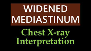 نتیجه جستجوی لغت [widened] در گوگل