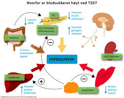 Diabetes i den samiske befolkningen. Diabetes Type 1 Og 2 Forskjell Diabeteswalls