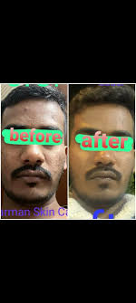 Al Harman Skin Care