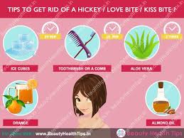 See full list on wikihow.com How To Get Rid Of A Hickey Love Bite Kiss Bite
