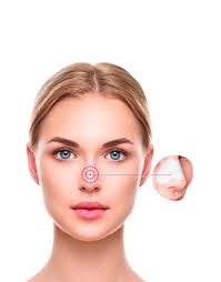 Behind the nose are the olfactory mucosa and the sinuses. Nose Strip Lanaform