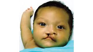 World Surgical Foundation Mission to Honduras