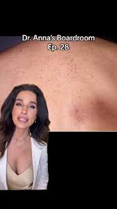 Image result for Notalgia Paresthetica