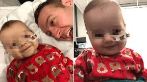 Bimbo passerà il Natale in ospedale in attesa del trapianto di cuore. Il  padre operato a gennaio