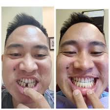 THE BEST 10 Dentists near SOUTH EL MONTE, CA 91733