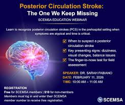 Image result for Posterior Circulation