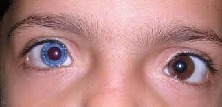 「オッドアイ」の画像検索結果