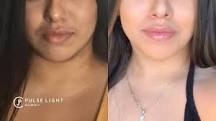 Image result