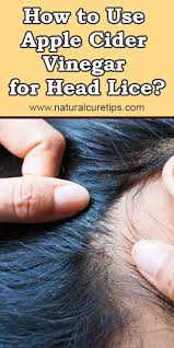 How To Use Apple Cider Vinegar For Head Lice Head Louse Apple Cider Vinegar For Hair Skin Tags Apple Cider Vinegar