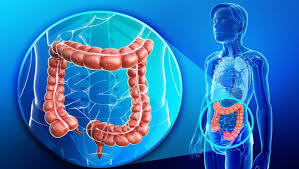 Image result for Chronic Constipation