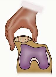 Image result for Patella Mobility Test