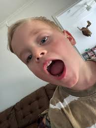 Boo boo salve heals child's injuries