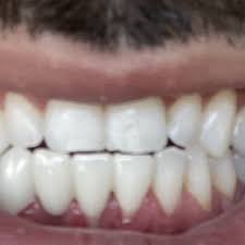 If a patient has a significant. All Care Dental By The Sea 11 Photos 42 Reviews General Dentistry 607 W Channel Islands Blvd Port Hueneme Ca Phone Number