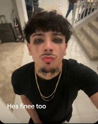 Edwin Calls Gabe Fine