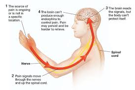 Image result for Pain Disorder