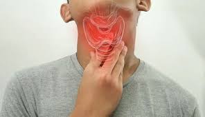 Image result for Pharyngitis