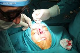 Image result for ‫جراحی زیبایی بینی‬‎