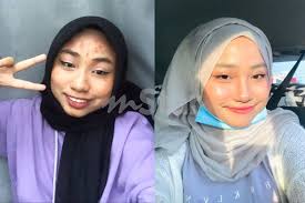 Jerawat pasir adalah jerawat bersaiz kecil dan halus yang biasanya tumbuh dengan begitu banyak di bahagian muka terutamanya di sekitar dahi dan pipi. Gadis Ini Buat Ramai Bengang Selepas Dedah Punca Muka Jerawat Teruk Dari Simpati Kini Ramai Doa Wajahnya Ada Masalah Kulit Viral Mstar