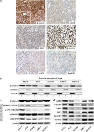We did not find results for: Ss18 Ssx Fusion Protein Induced Wnt B Catenin Signaling Is A Therapeutic Target In Synovial Sarcoma Oncogene