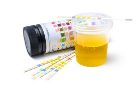 Mildew smelling or musty smelling urine refers to moldy or stale smelling urine. Urine Smells Like Ammonia Indication Of Any Medical Condition