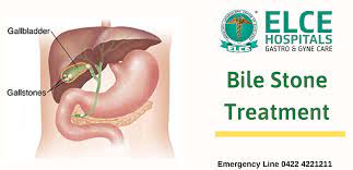 Maybe you would like to learn more about one of these? Bile Stone Treatment Gallstones Treatment Elce Hospitals