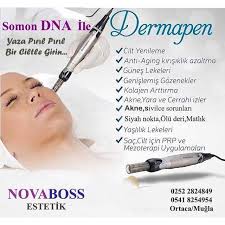 Yaz Gelirken Cildinizi Dermapen Le Korumaya Alin Tum Cilt Sorunlarinizda Somon Dna Dermapen Orjinal Akne Gozenek Sorunu Matlik Sivilce Ton Farki Olu Deri