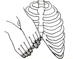 Pin On Ehlers Danlos Syndrome Hypermobility Syndrome