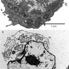 Check spelling or type a new query. Pdf Chapter One Analyzing Morphological And Ultrastructural Features In Cell Death