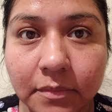 RENOUVELE BODY SOLUTIONS