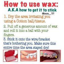 How to apply wax for braces How To Use Orthodontic Wax Braces Braces Quotes Getting Braces Braces Tips Dental Braces