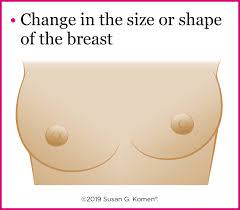The inflammatory breast cancer turns the affected breast red and painful. Warning Signs Of Breast Cancer Do You Know What To Watch For