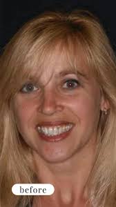 Smile Maker of Texas