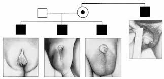 Check spelling or type a new query. Pdf Genome Wide Screening Of Biomarkers In Androgen Insensitivity Syndrome Ais Semantic Scholar