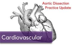 Image result for Aortic Dissection